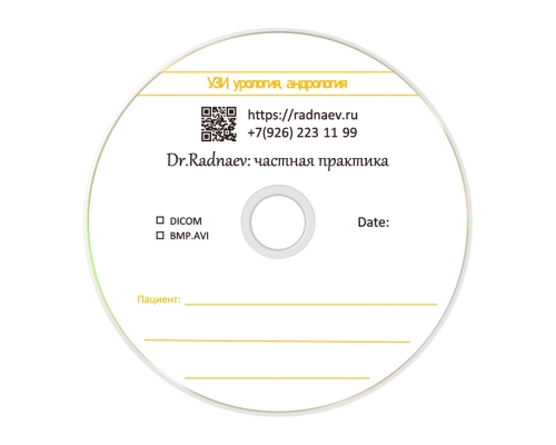 Печать на DVD-R дисках (Шелкография) 4,7 Гб